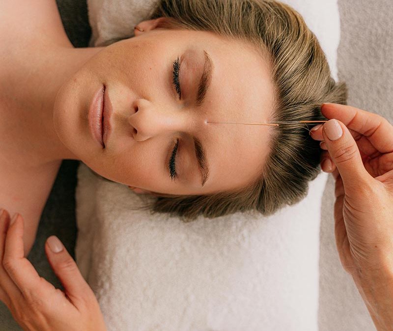 Acupuncture in Warrington
