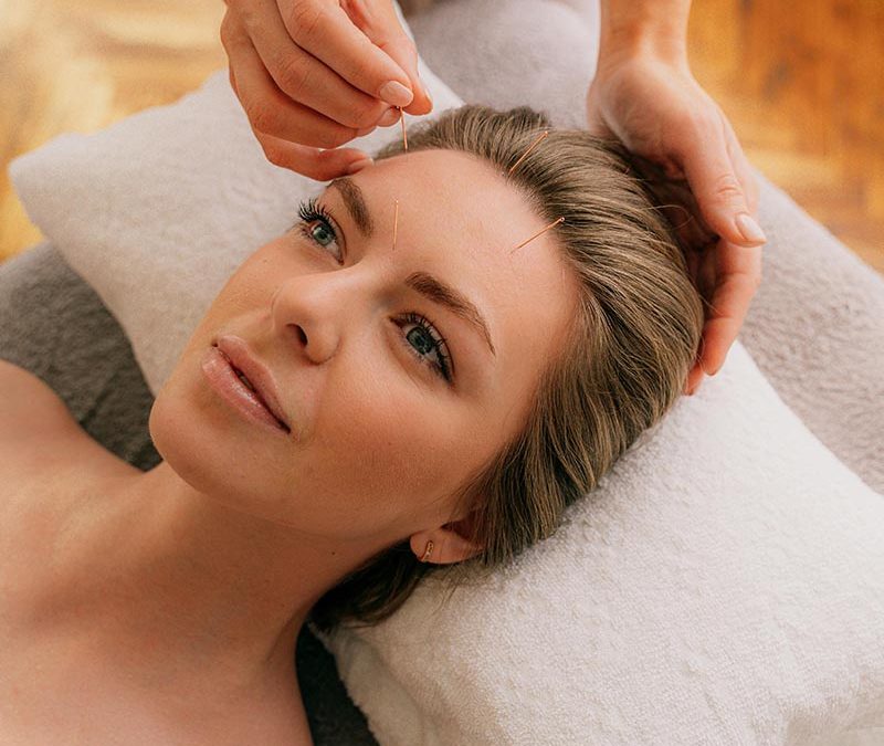 Fertility Acupuncture Treatment in Warrington