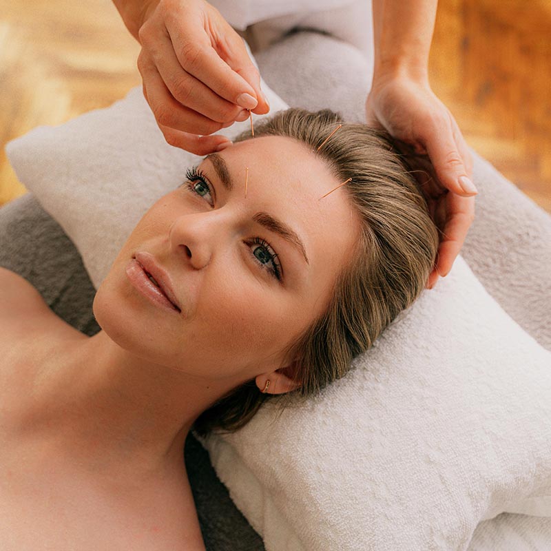 acupuncture treatment in warrington